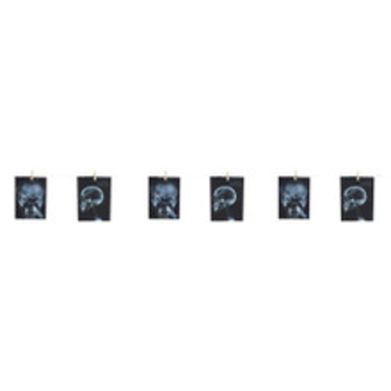 GARLAND-TORTURE X-RAY 63 IN.